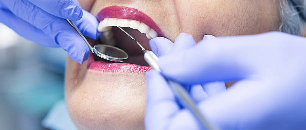 Best Emergency Treatment for Dental Infections or Abscesses in Arnold, MO